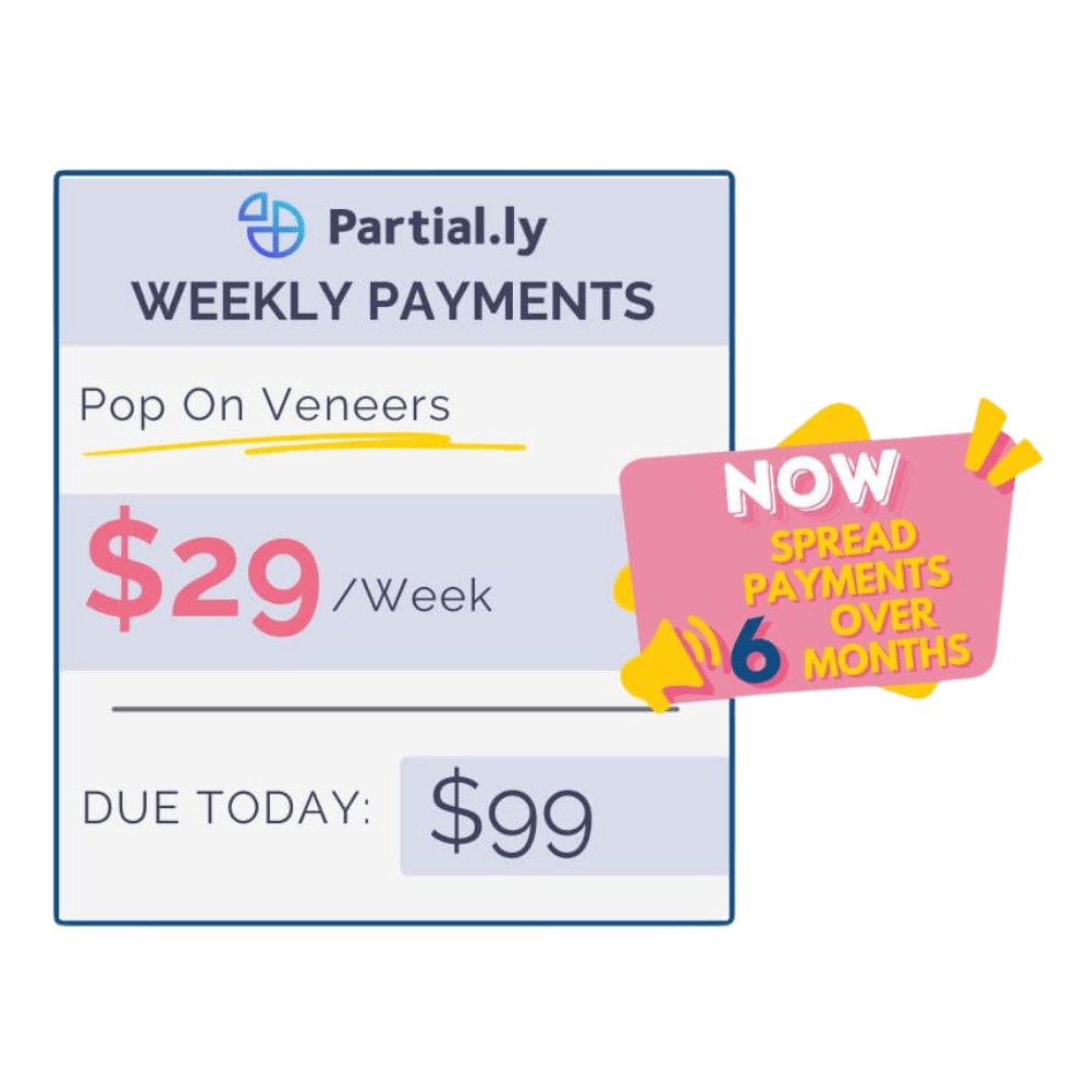 Payment Plan - Poponveneers - With At Home Impression Kit