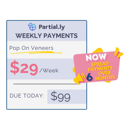 Payment Plan - Poponveneers - With At Home Impression Kit