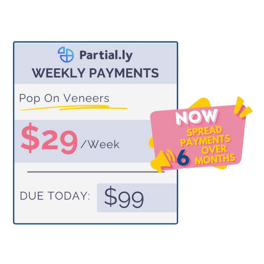 Payment Plan - Poponveneers - With At Home Impression Kit