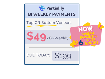 Bi-Weekly Payment Plan - Poponveneers with At Home Impression Kit