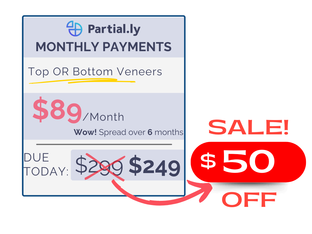 Monthly Payment Plan - Poponveneers with At Home Impression Kit - $50 Off