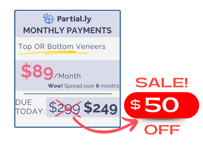 Monthly Payment Plan - Poponveneers with At Home Impression Kit - $50 Off