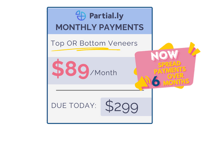 Monthly Payment Plan - Poponveneers with At Home Impression Kit