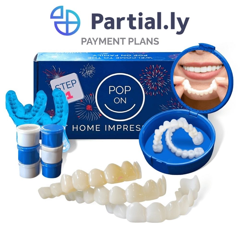 Payment Plan - Poponveneers - With At Home Impression Kit