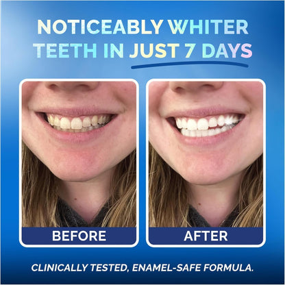 Pop On Teeth Whitening Strips for Sensitive Teeth and Gums