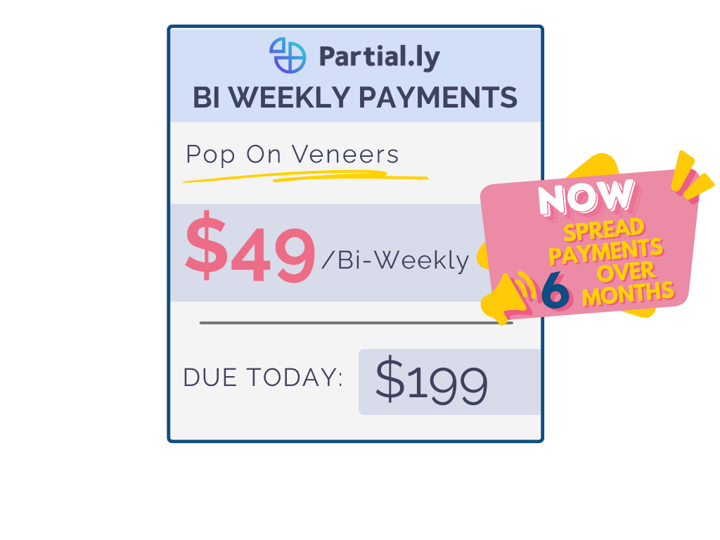 Bi-Weekly Payment Plan - Poponveneers with At Home Impression Kit
