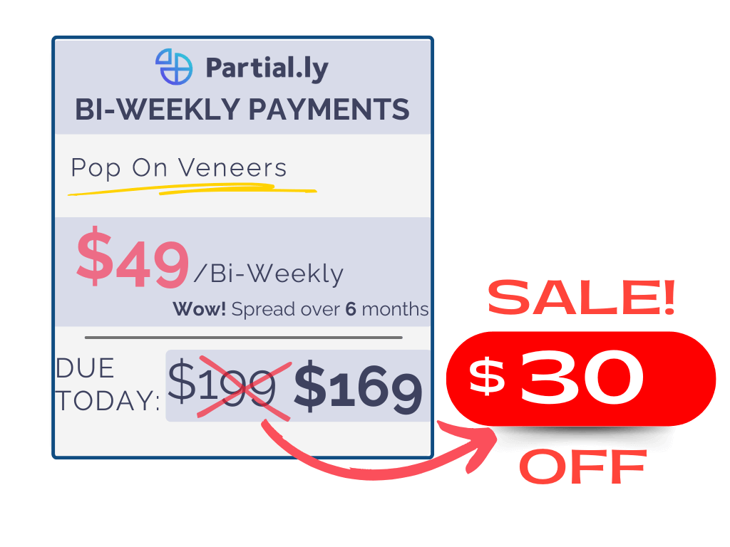 Bi-Weekly Payment Plan - Poponveneers with At Home Impression Kit - $30 Off