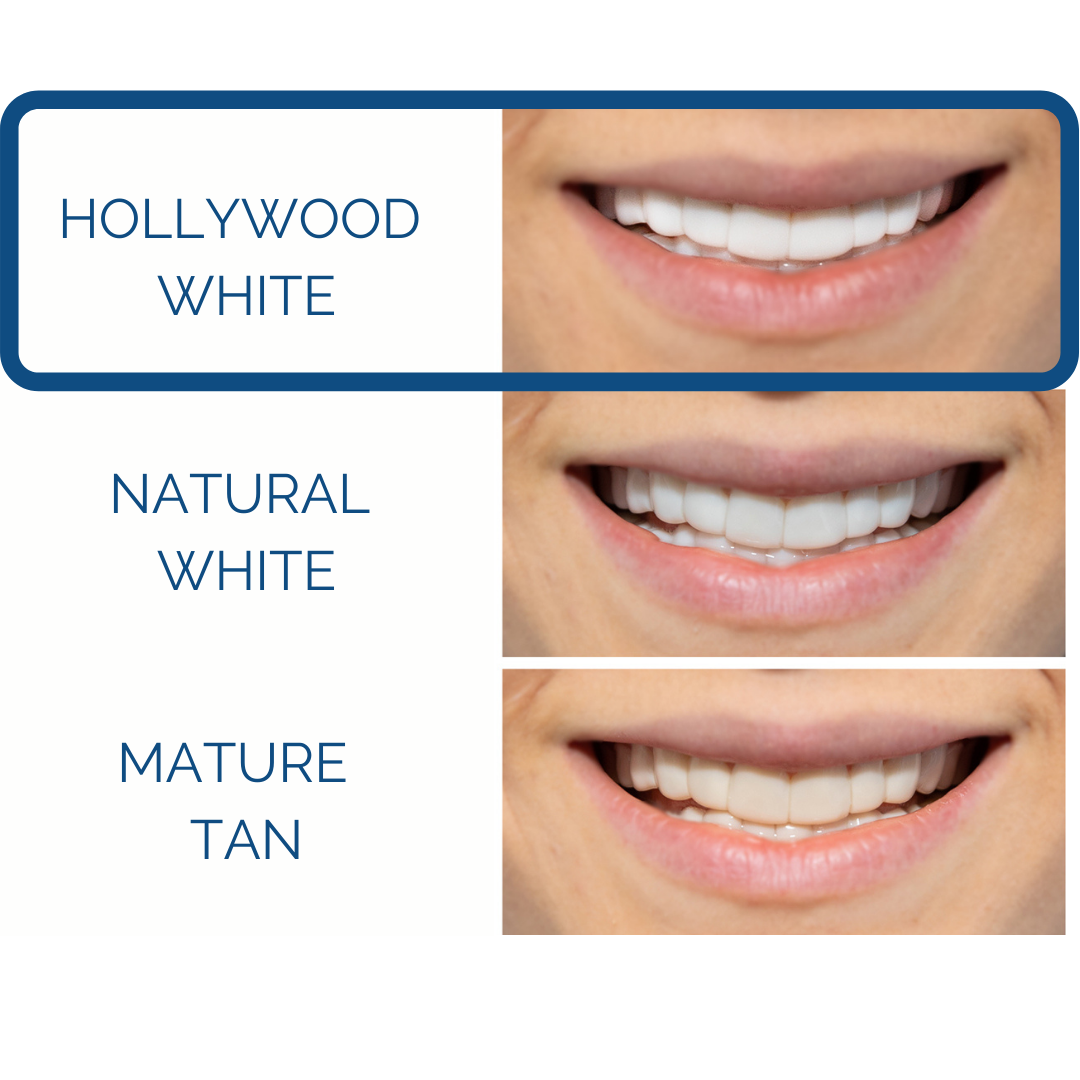 Poponveneers for Friends & Family with Impression Kit