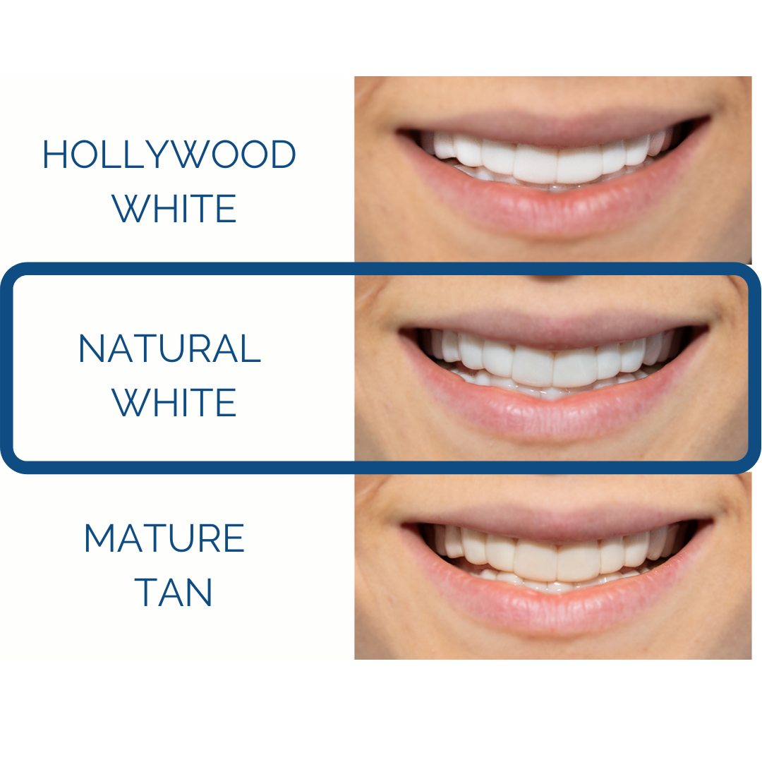 Poponveneers for Friends & Family with Impression Kit