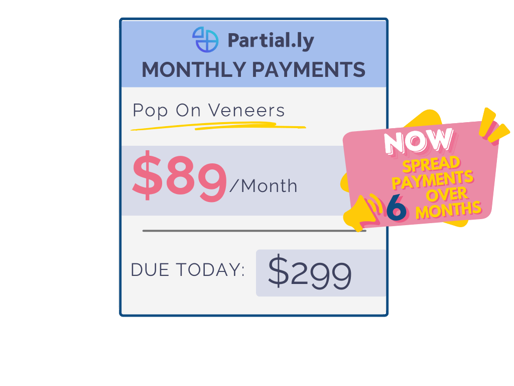 Monthly Payment Plan - Poponveneers with At Home Impression Kit
