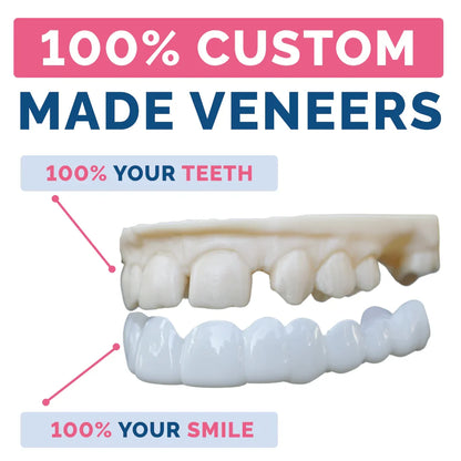 Poponveneers Digital - From Your Own Scans