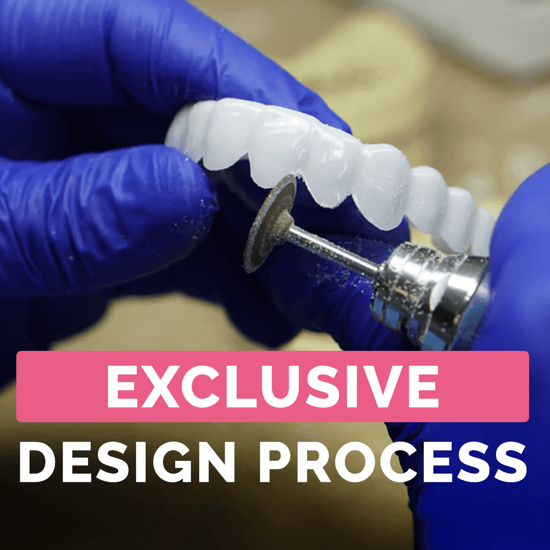 Weekly Payment Plan - Poponveneers with At Home Impression Kit