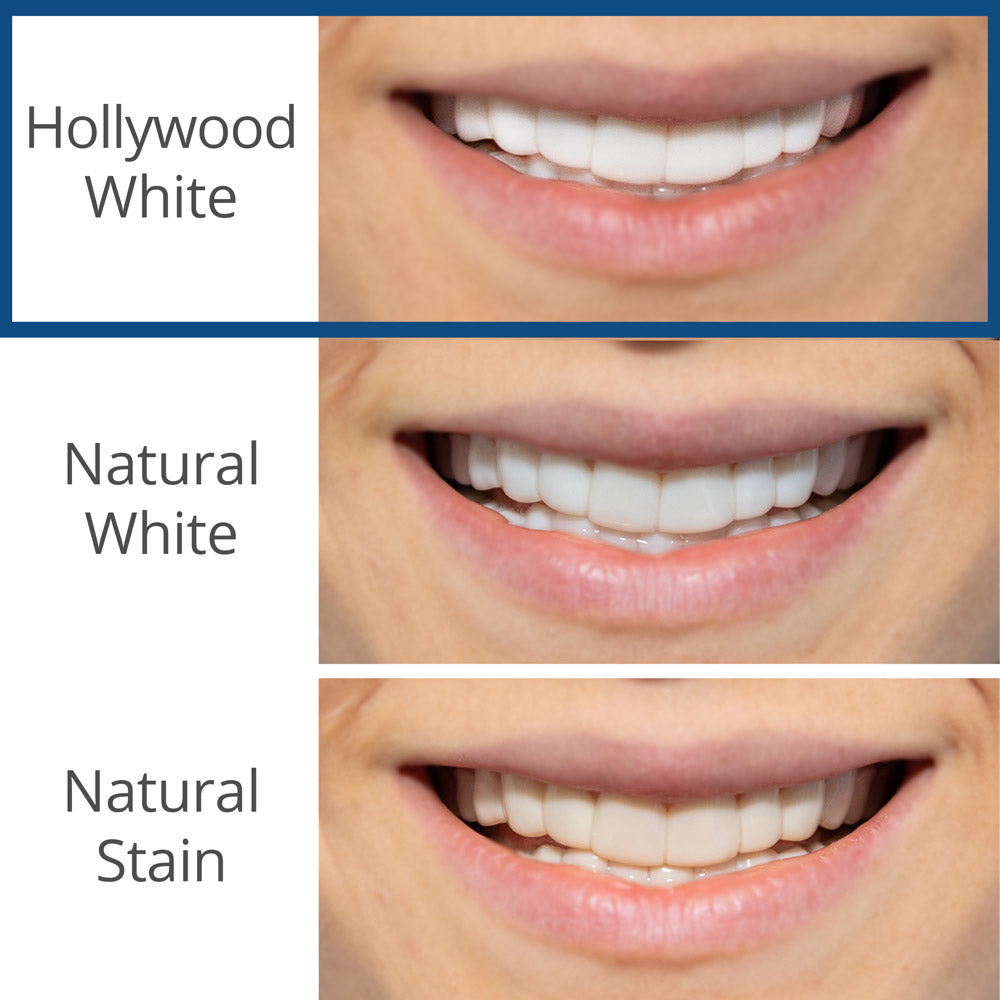 Reward 2 | Spare Veneer | Single Arch + 30 Day Tablets ($195 Value)