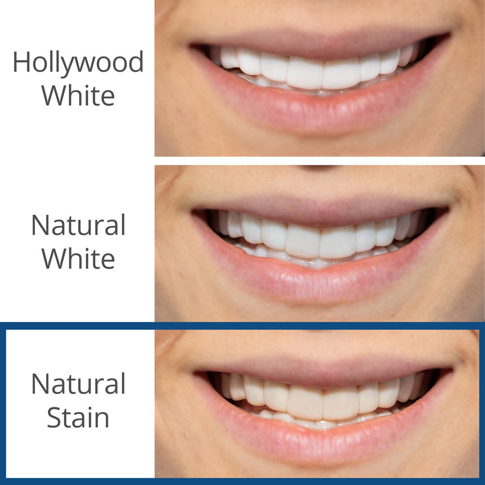 Reward 2 | Spare Veneer | Single Arch + 30 Day Tablets ($195 Value)