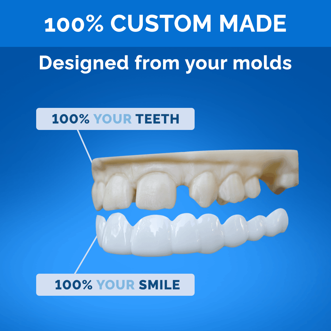 Poponveneers with Impression Kit