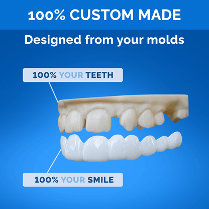 Poponveneers with Impression Kit