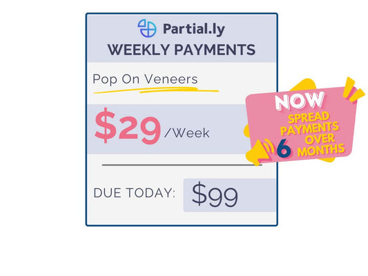 Weekly Payment Plan - Poponveneers with At Home Impression Kit