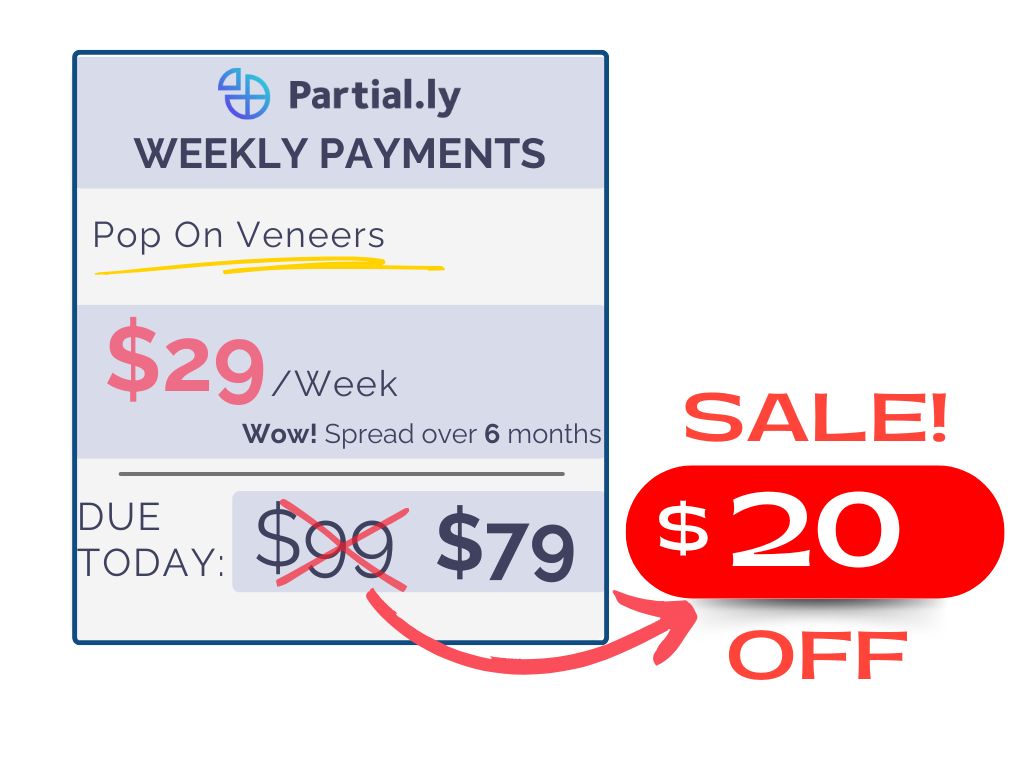 Weekly Payment Plan - Poponveneers with At Home Impression Kit - $20 Off